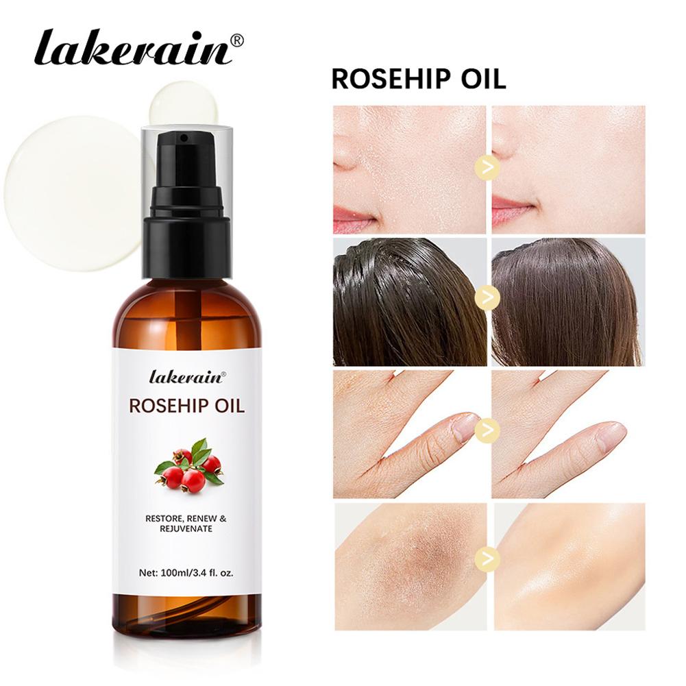 น้ำมันโรสฮิปสำหรับผิวหน้าและผิ - Cold Pressed Rose Hip บทวิจารณ์และราคา