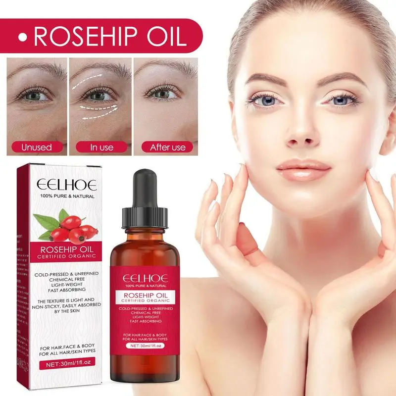 30ml Organic Rosehip Seed Oil  - Cold Pressed Rose Hip บทวิจารณ์และราคา