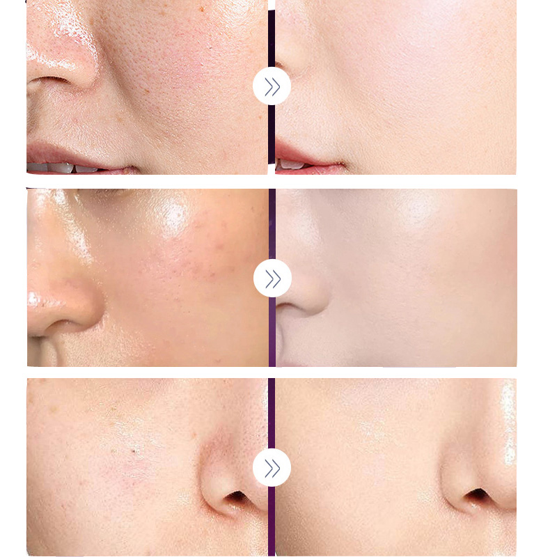 คอนซีลเลอร์บำรุงผิวหน้าครีมบำร - Luxury Skincare Women บทวิจารณ์และราคา